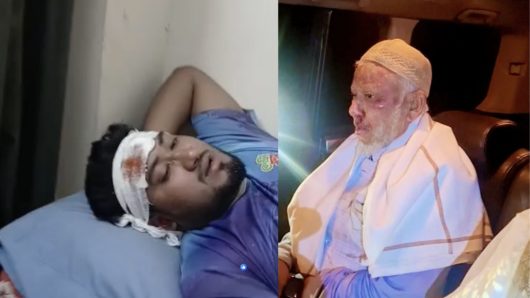 জুড়িতে জামায়াত নেতাকর্মীদের ওপর হামলার অভিযোগ, আহত একাধিক