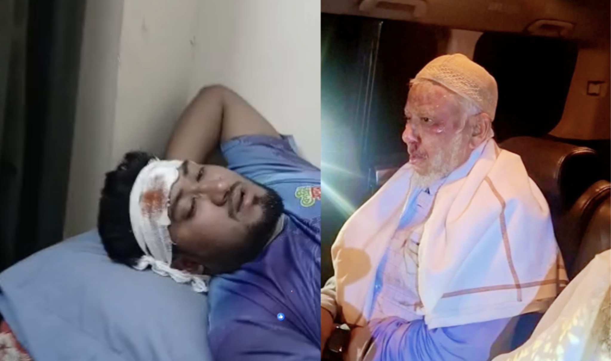 জুড়িতে জামায়াত নেতাকর্মীদের ওপর হামলার অভিযোগ, আহত একাধিক