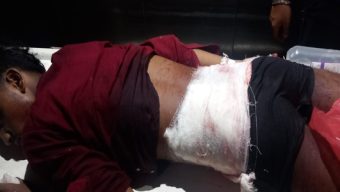 সিলেটে দুর্বৃত্তদের হামলায় দীপ্ত ঘোষ নামক এক যুবক আহত