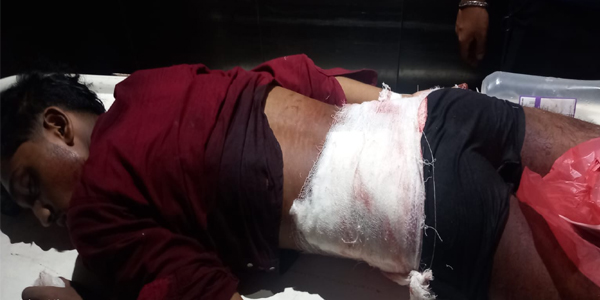 সিলেটে দুর্বৃত্তদের হামলায় দীপ্ত ঘোষ নামক এক যুবক আহত